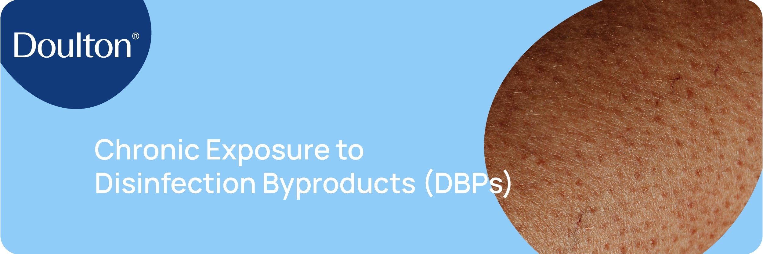 Chronic Exposure to Disinfection Byproducts (DBPs)